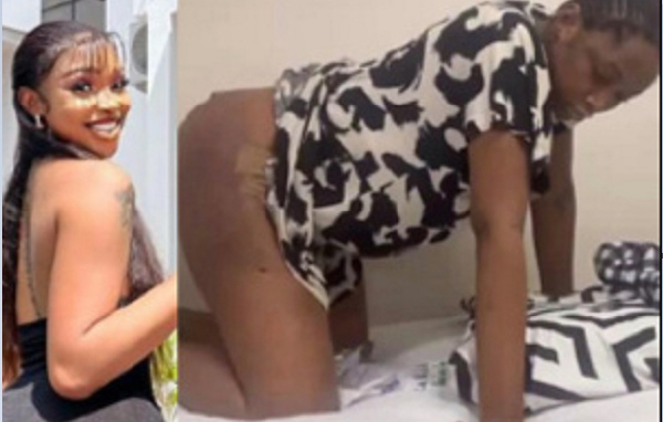 I’ve spent all my life savings on diapers after botched surgery – Nigerian transvestite cries