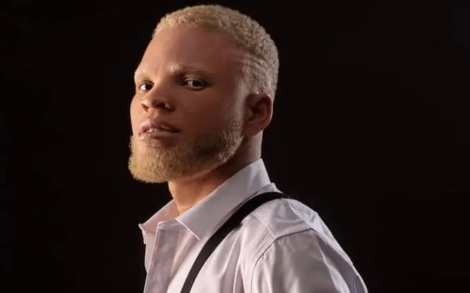 Record labels rejected me due to my albinism, poor eyesight – Byno Ayoni