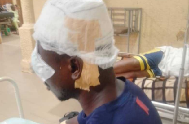 PHOTOS: SHS student stabs teacher in the eye at Offinso