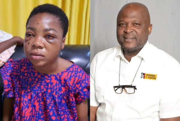 Ibrahim Mahama offers support to Suzzy Pianamang, victim of Bantama SDA SHS shooting