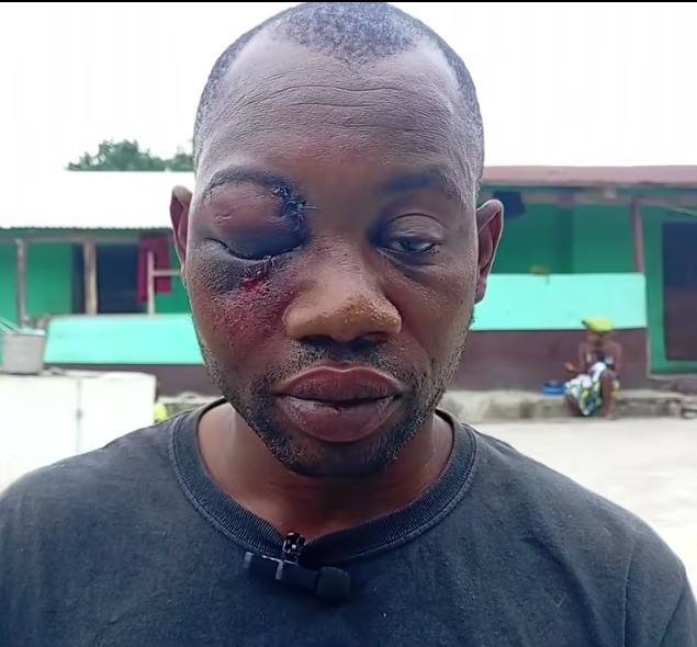 Gold Dealer narrates how he survived gunshots and machete attack by armed robbers at Assin Fosu