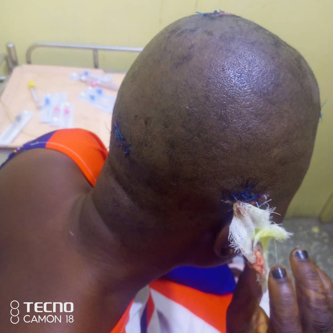 Gold dealer nearly kills fiancée over cheating allegations