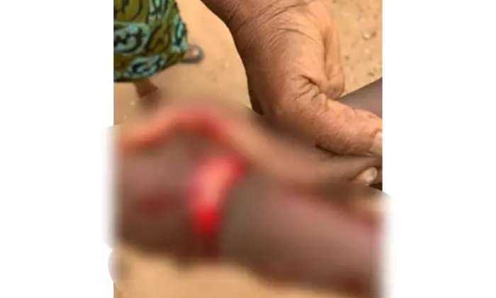 Kotei in Ashanti Region: 64-year-old man slashes left wrist of 9-year-old boy with cutlass over sugarcane