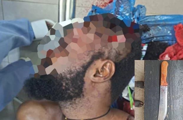 Nyinahin: 32-year-old man in critical condition after being attacked by his girlfriend with knife