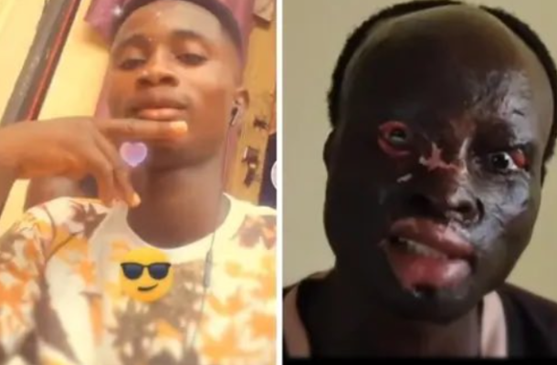 A/R: Houseboy jailed 7 years for acid attack on SHS graduate A/R: Houseboy jailed 7 years for acid attack on SHS graduate