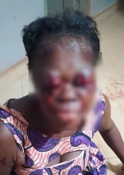 Man arrested for stabbing woman in both eyes