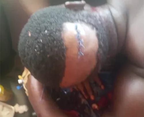 Man who reported nail attack arrested for brutal revenge stabbing in Atwima Koforidua Man who reported nail attack arrested for brutal revenge stabbing in Atwima Koforidua