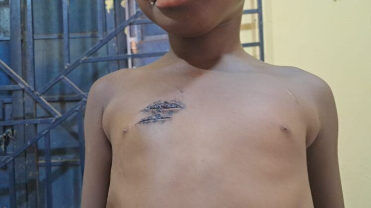 Nursing mother arrested for allegedly inflicting blade wounds on 5-year-old girl in Bole