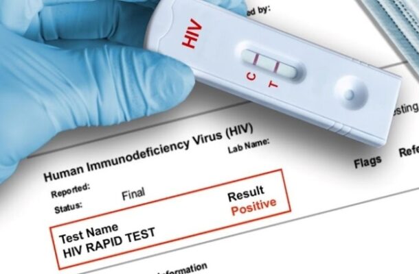 AIDS Commission clarifies 1,300 HIV test results in security service recruitment AIDS Commission clarifies 1,300 HIV test results in security service recruitment